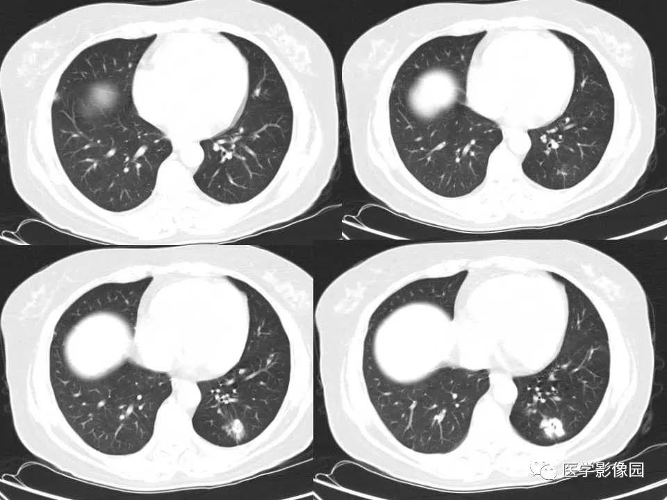 金光佛4949免费资料,多元化诊断解决_UTJ55.656影像处理版
